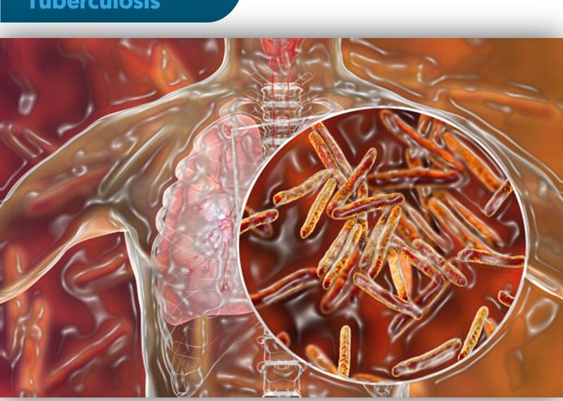Día Mundial De La Tuberculosis