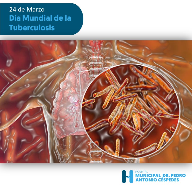 Read more about the article Día Mundial De La Tuberculosis